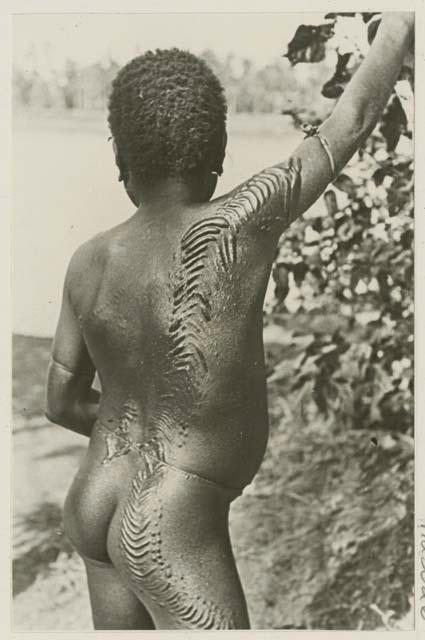 Person with scarification