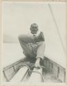 Man sitting on boat showing foot with elephantiasis