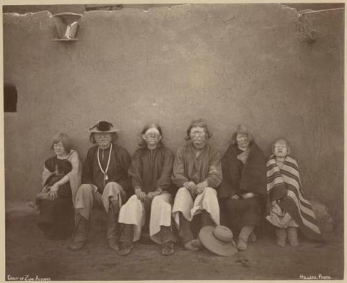 Group of Zuni people with albinism