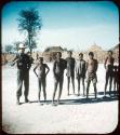 Slide from Marshall Expedition: "RHD and Bushmen in Angola"