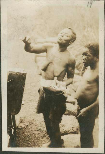 Woman displaying personal decoration - scarification on Motor Road from Feradge to Buta, connecting posts of the interior with upper Nile