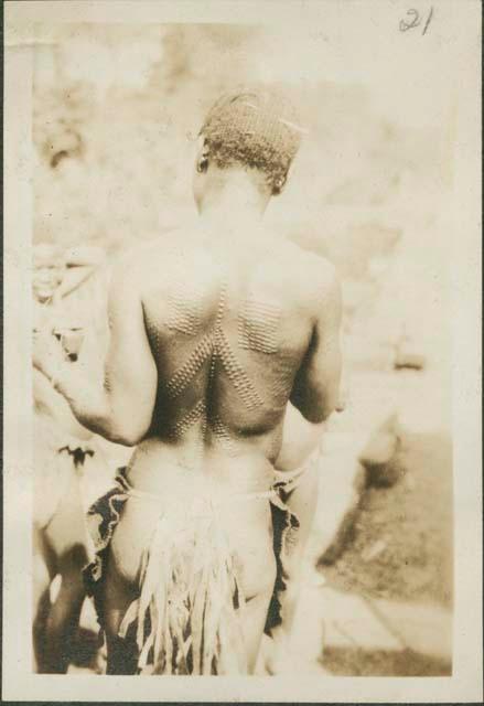 Woman displaying personal decoration - scarification on Motor Road from Feradge to Buta, connecting posts of the interior with upper Nile