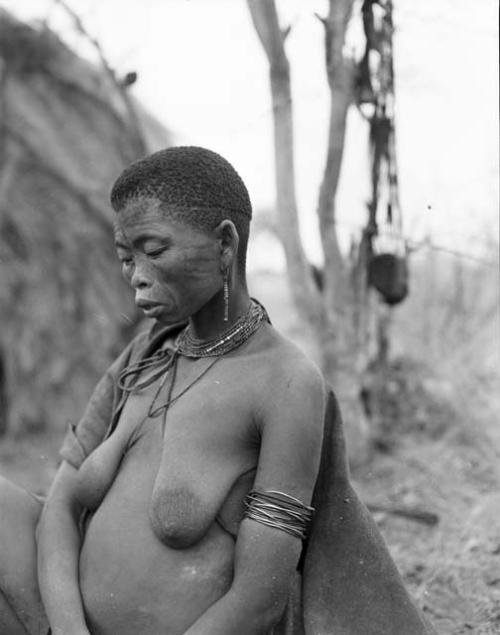 !Ungka (daughter of "Old Gau" and sister of //Kushay) sitting, with scarification on her face visible