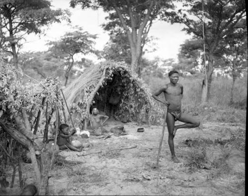 Man standing on one leg, leaning against his stick, with a woman and a child sitting in a skerm behind him