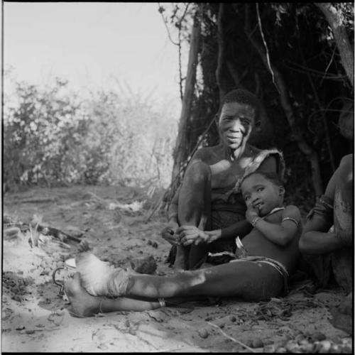 Woman holding nuts in her hand, sitting with a child with a bandaged foot in front of a skerm