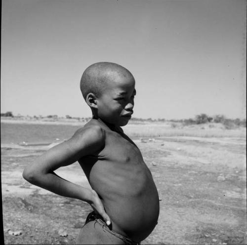 Boy with a shaved head standing in the veld, profile, with a pan in the background