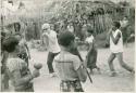 Dancers and musicians, one with albinism