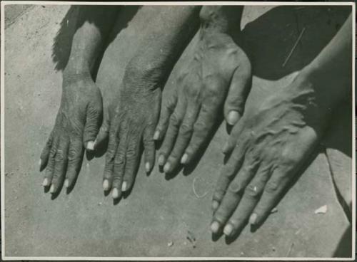 /Naoka (wife of "Gao Medicine) and a man putting their hands on a kaross