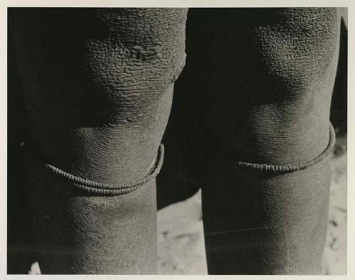 Person wearing beaded bracelets on their knees, close-up