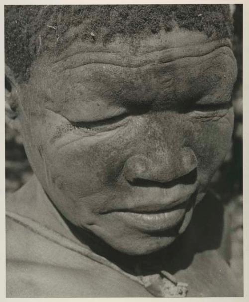 DaSi!Na, close-up, with dirt or charcoal on her face, used for healing a headache (overlaps with another negative)