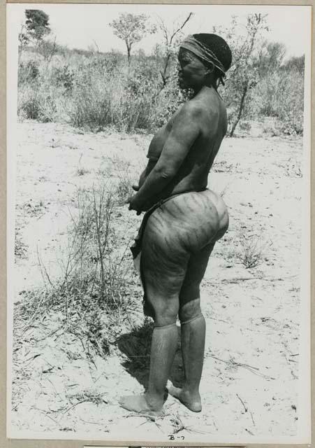 "61-5-23": Woman standing, showing her scarification