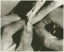 Person sewing, close-up of hands thrusting cord through a hole (print is a cropped image)