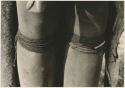 Person's legs with beads worn by Ju/'hoan women below their knee and a thong bracelet (print is a cropped image)