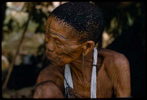 Elderly woman with forehead scarification