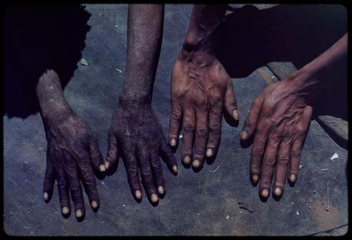 Physical Type: Two people showing their hands, palms down, close-up