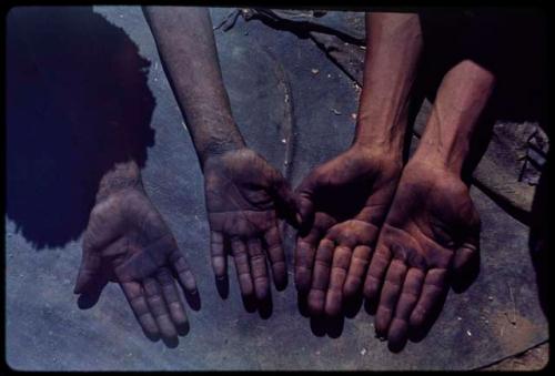 Physical Type: Two people showing their hands, palms up, close-up