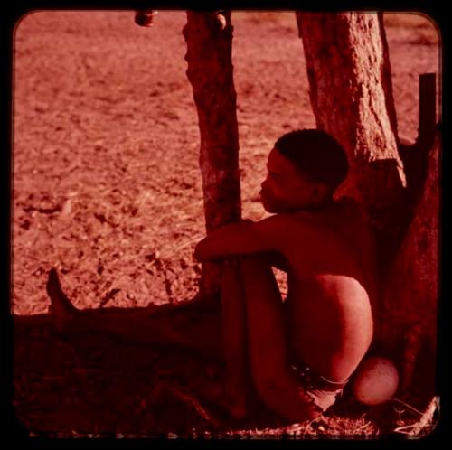 Boy sitting in the shade of a tree