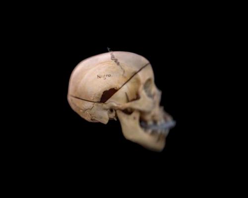 Skull Inscribed 'Negro.' , The Mütter Museum of The College of Physicians of Philadelphia, Philadelphia, PA 1/15